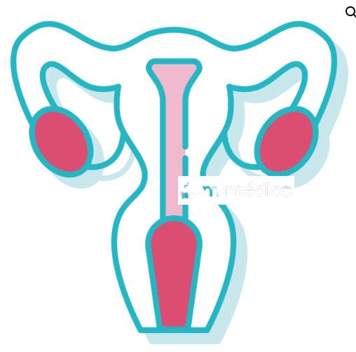 VAGINITIS SCREENING 1 UNIDAD INSTITUTO DE MICROECOLOGIA
